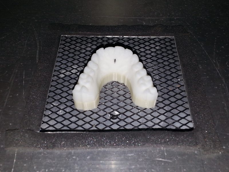 Moulage des dents almos dudley