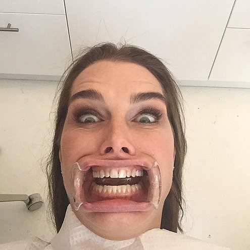 brooke-shields-dentist-selfie